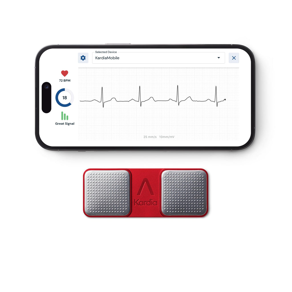KardiaMobile 1-Lead Personal EKG Monitor